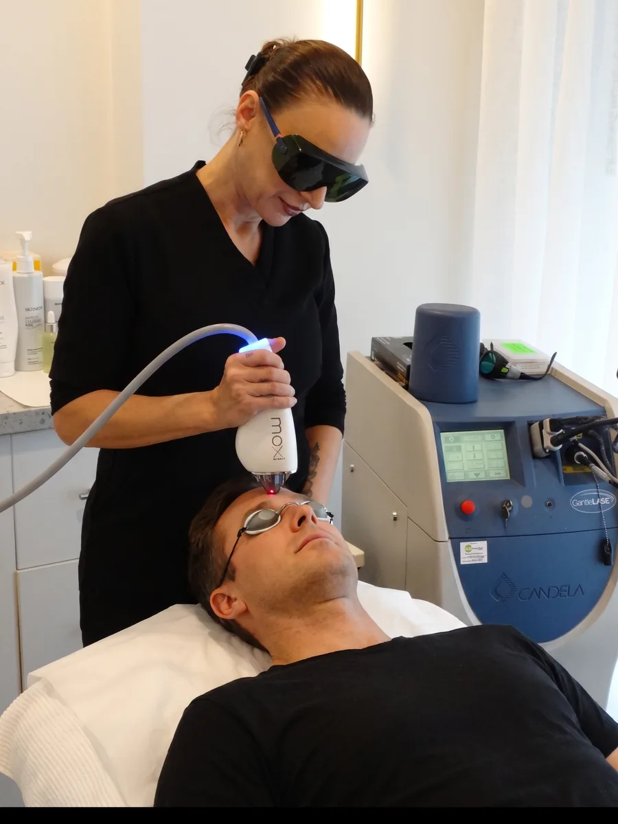 A MOXI laser treatment being performed at the neoSKiN clinic