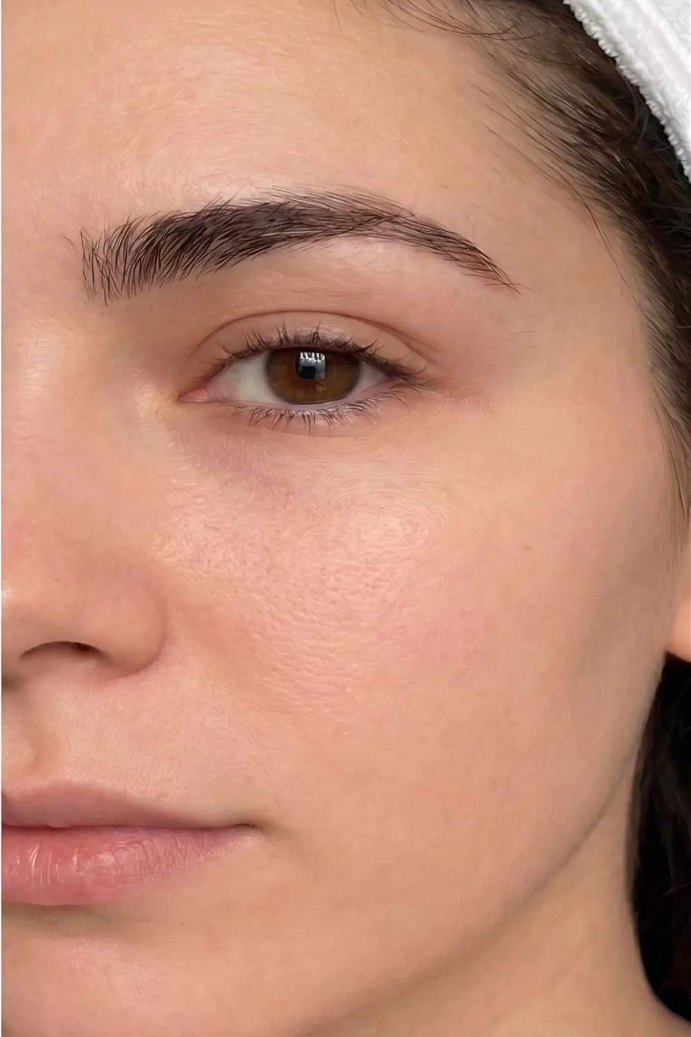 The same client's skin after treatment