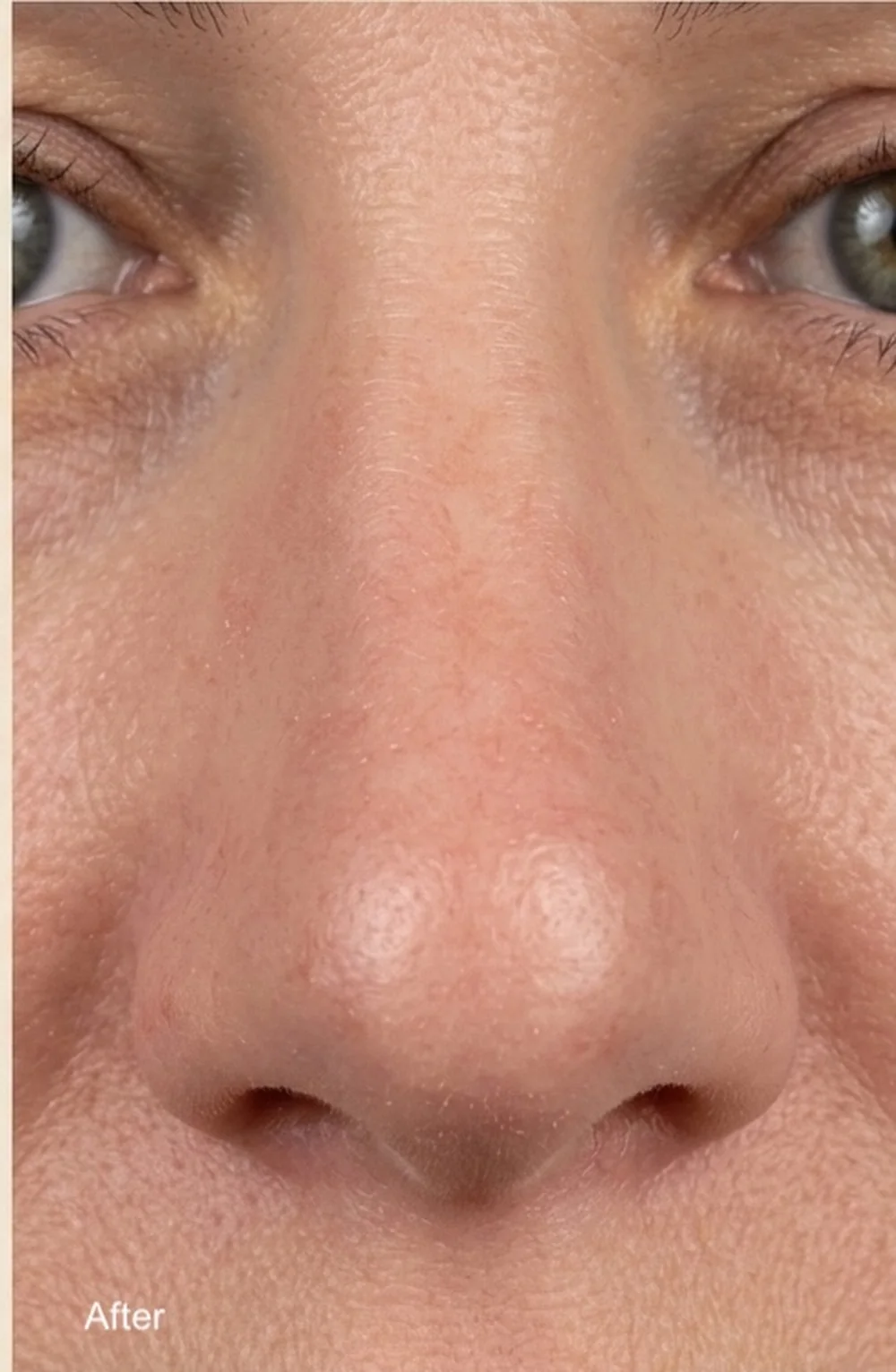 The same client's skin after treatment
