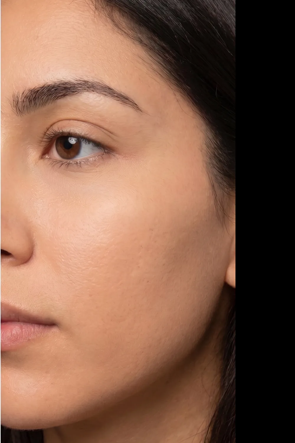 The same client's skin after treatment