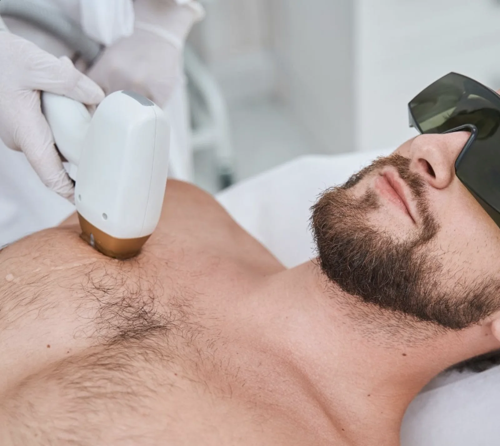 Laser hair reduction treatment being performed on a man's chest