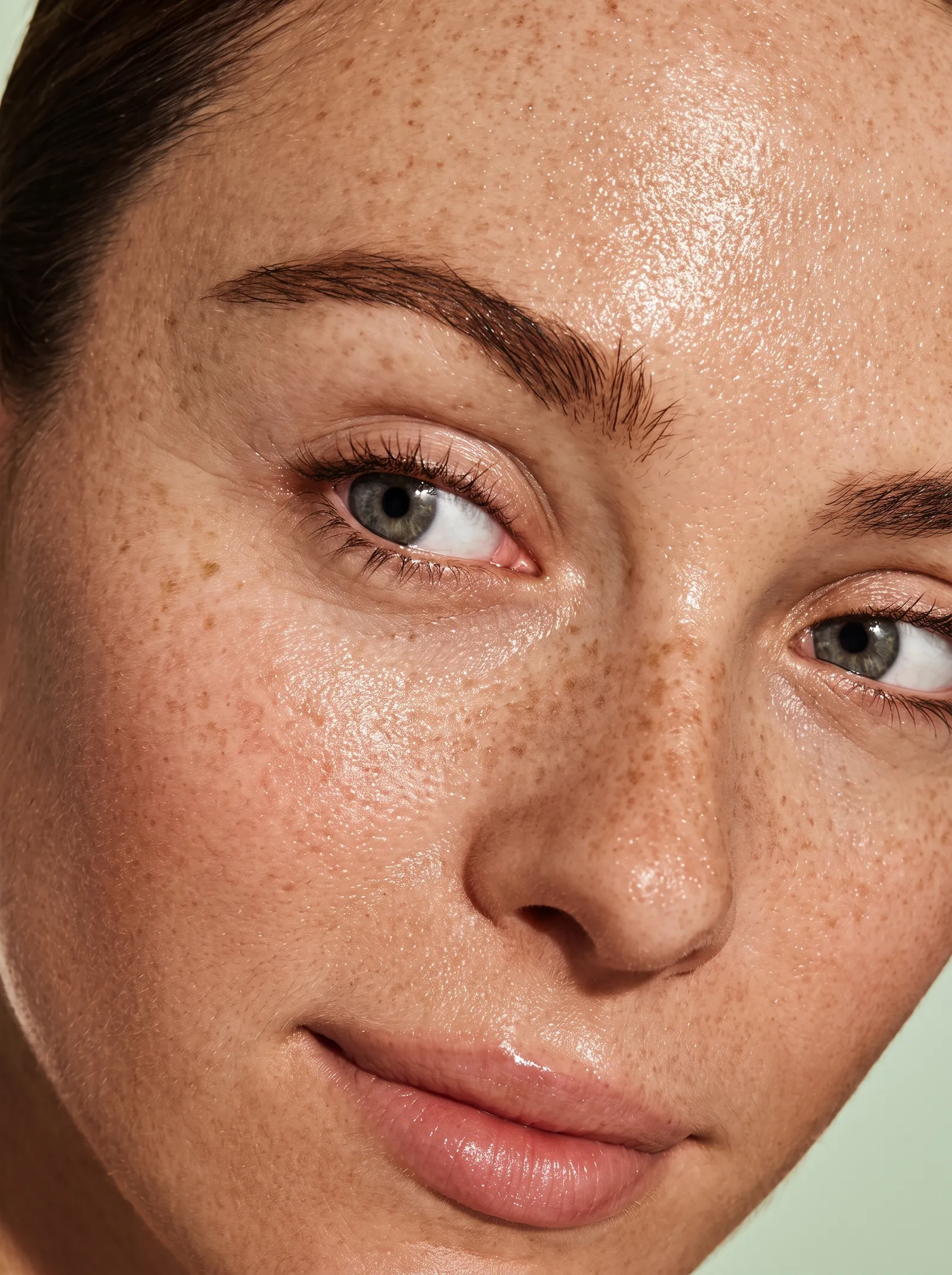 Close portrait showing freckling and sun-related pigmentation across the cheeks and nose